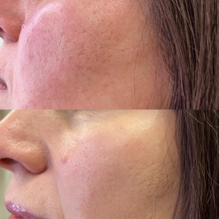 Nanoasia BC Cream-Cushion papildymas mišriai/riebiai odai SPF50+ 15g