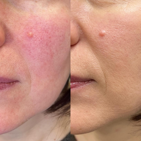 Nanoasia BC Cream-Cushion papildymas mišriai/riebiai odai SPF50+ 15g