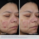 Obagi SUZANOBAGIMD Super Antioxidant serumas 30ml