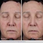 Obagi ELASTIderm Lift Up & Sculpt veido kremas 50ml