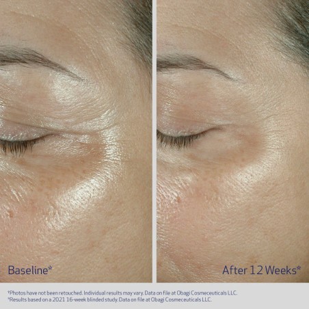 Obagi ELASTIderm paakių kremas Eye Treatment Cream 15ml